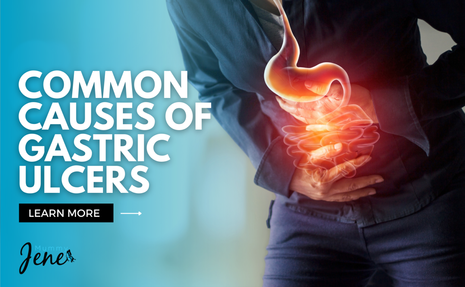 some-common-causes-of-gastric-ulcers